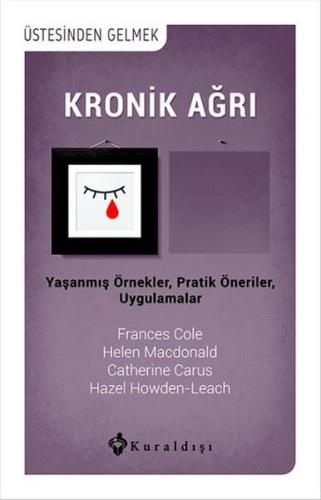 Kronik Ağrı Frances Cole
